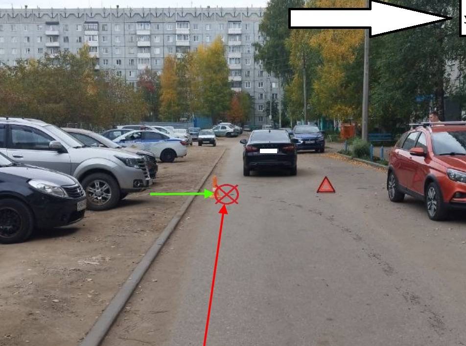 В Сыктывкаре легковушка сбила выбежавшую на дорогу девочку