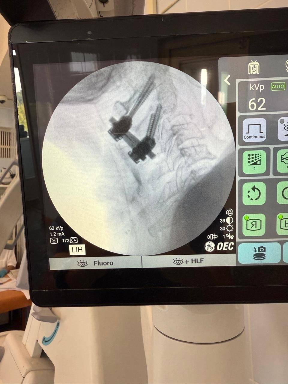 cKr20W_53ADtJr-E1lyozADEOPtbVppLKmDj9zuU7aw3FyH9IE32ibJIfK_E1S5GmUG8cudQJdCLDvNmbIXr_nEV.jpg cKr20W_53ADtJr-E1lyozADEOPtbVppLKmDj9zuU7aw3FyH9IE32ibJIfK_E1S5GmUG8cudQJdCLDvNmbIXr_nEV.jpg