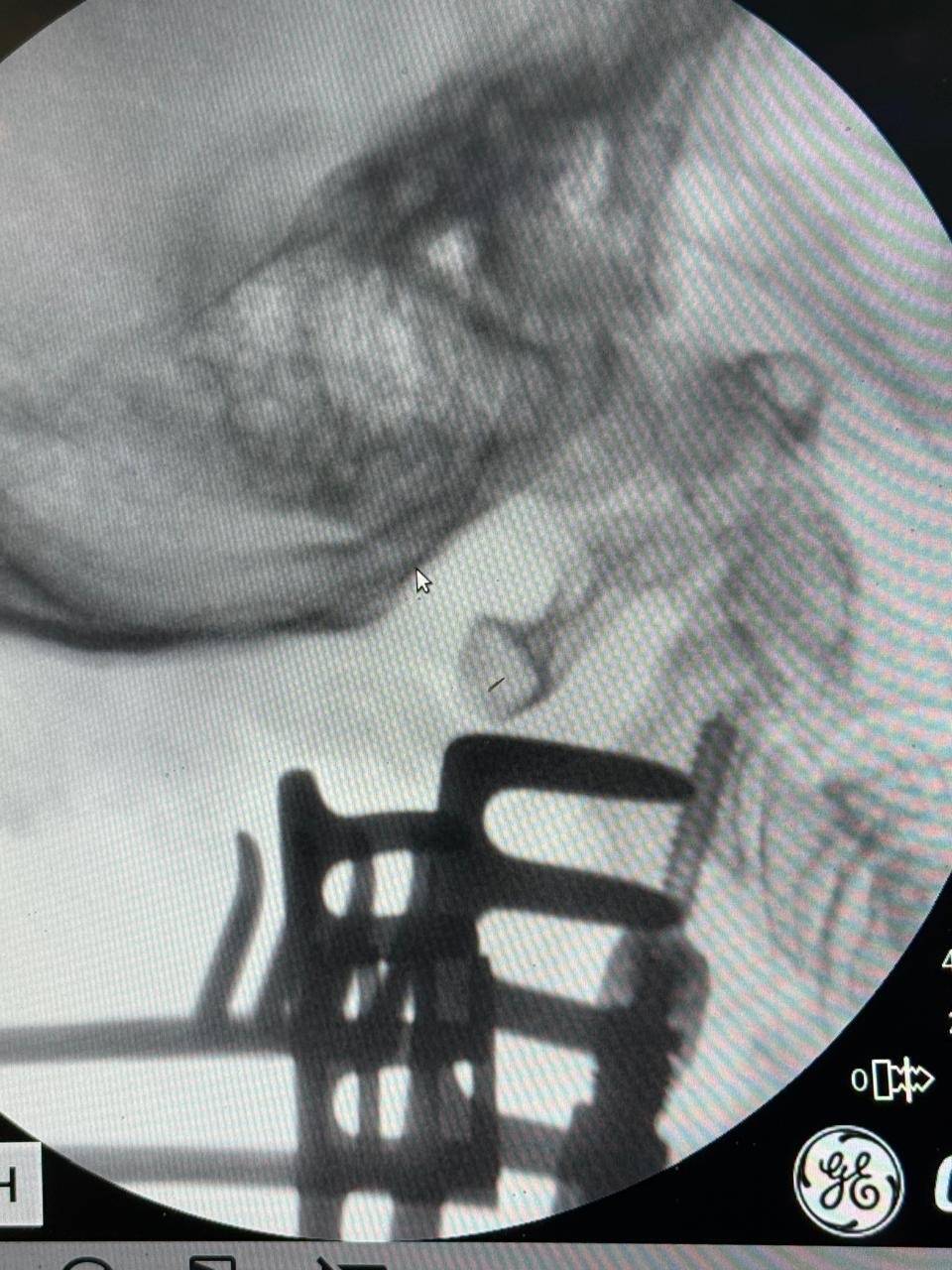 wvvRF3EhRCC1cRLQiq0axSbzSe_A_Oa46DiNP8gGO0TBgscRx9cboCttCFZM_Yj-B26-F7b07NbfPgiYEuqFsRxz.jpg wvvRF3EhRCC1cRLQiq0axSbzSe_A_Oa46DiNP8gGO0TBgscRx9cboCttCFZM_Yj-B26-F7b07NbfPgiYEuqFsRxz.jpg