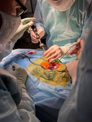 Нейрохирурги Коми впервые провели операцию по методике Хармса на шейном позвонке